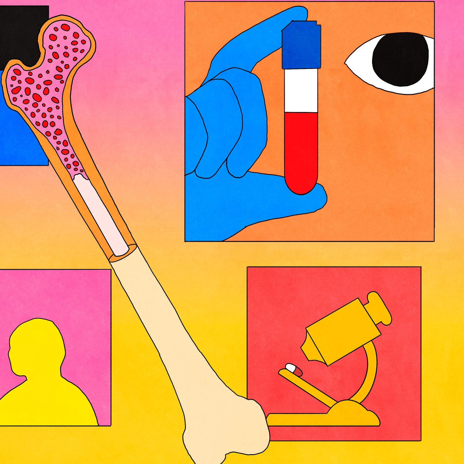 4 Things to Know About a Rare Blood Cancer Diagnosis
