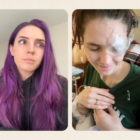 I’m 26 and Almost Lost My Eye After Showering in My Contacts